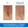 Урьяж Цика-крем с медью и цинком SPF50+, 40 мл (Uriage, Bariederm) фото 3